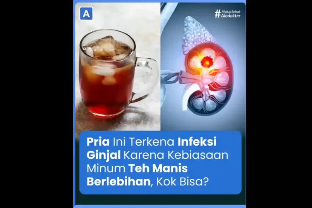 Teh Manis Bisa Sebabkan Infeksi Ginjal